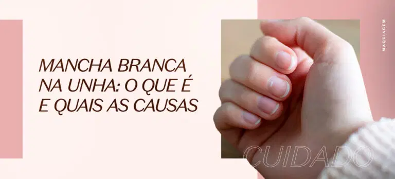 Mancha branca na unha: o que é e quais são as causas