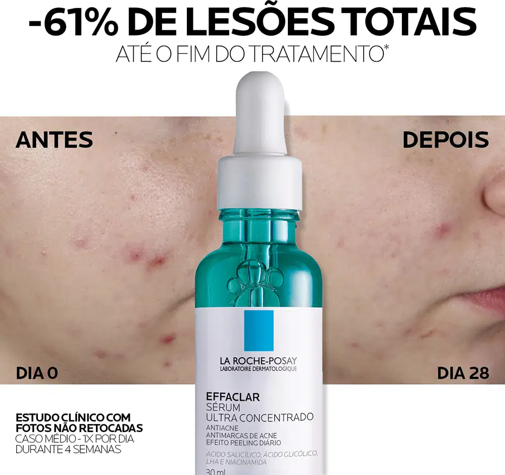 Frasco de vidro verde com conta-gotas branco contendo o sérum Effaclar Ultra Concentrado da marca La Roche-Posay, um produto antiacne com ácido salicílico e ácido glicólico.
