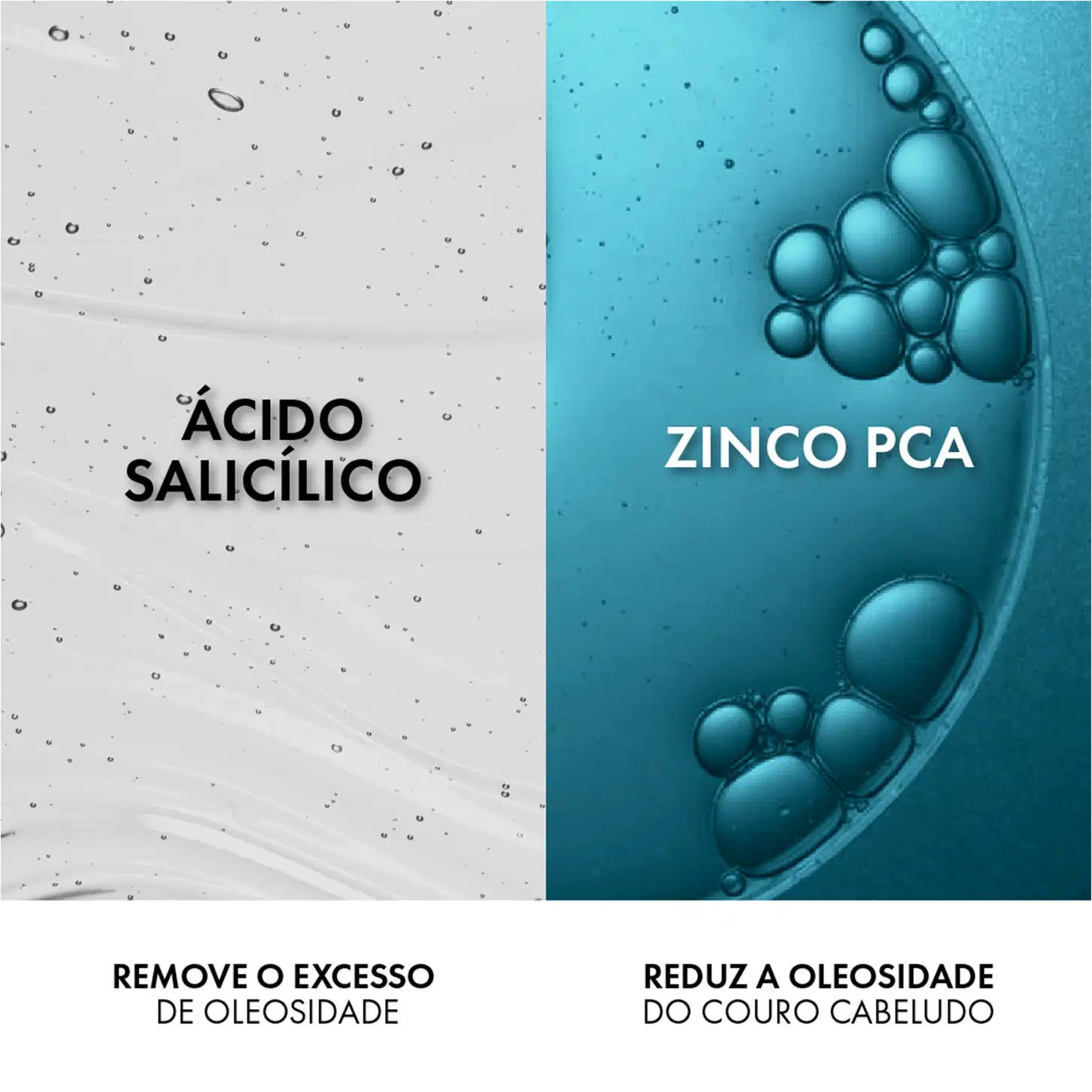 Composto por dois componentes: Ácido Salicílico remove o excesso de oleosidade e Zinco PCA reduz a oleosidade do couro cabeludo.