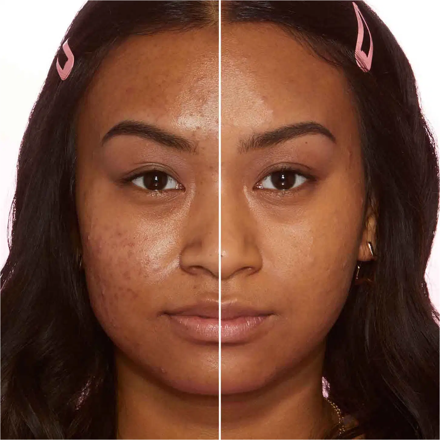 A imagem mostra o rosto de uma mulher, com uma linha dividindo o meio do rosto. Do lado esquerdo está sem base e do lado direito, ela está com base no rosto.