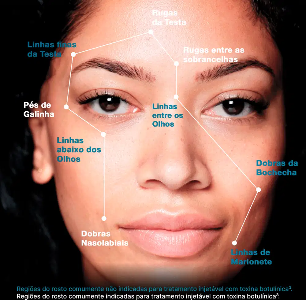 Imagem de rosto feminino com marcações indicando diferentes regiões e linhas do rosto, com texto em português descrevendo cada uma delas.