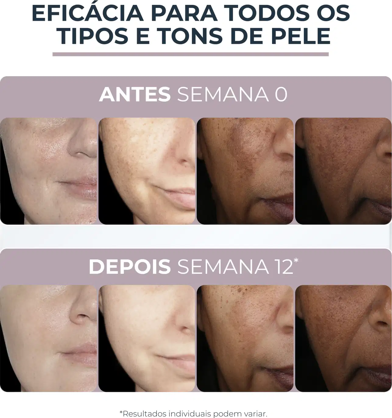 Creme Facial Eucerin Anti-Pigment Clareador Dia FPS 30, 50ml.