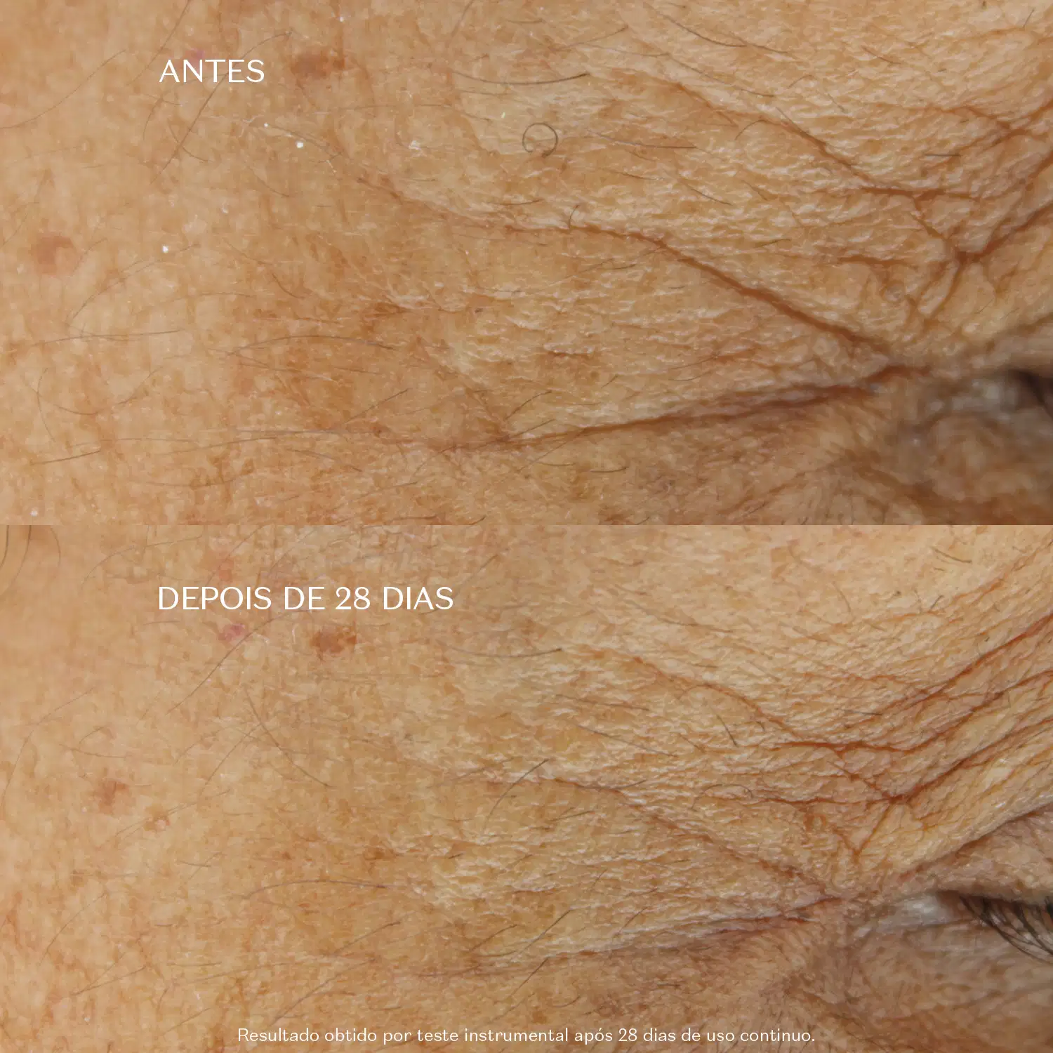 Imagem dividida em dois mostra o antes e depois em close-up de pele de pessoa idosa, enfatizando as rugas próximas ao canto do olho e o resultado do uso contínuo do produto após 28 dias.
