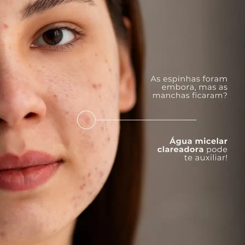 Água Micelar Clareadora Dermo Skin Hidrata Labotrat 110ml