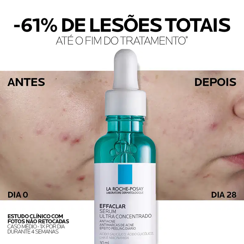 Frasco de vidro verde com conta-gotas branco contendo o sérum Effaclar Ultra Concentrado da marca La Roche-Posay, um produto antiacne com ácido salicílico e ácido glicólico.