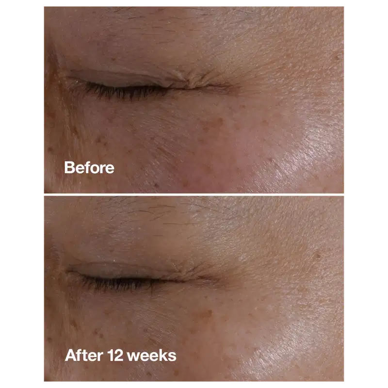 Clinique Smart Clinical Repair - Sérum Redutor de Linhas para Área dos Olhos 15ml
