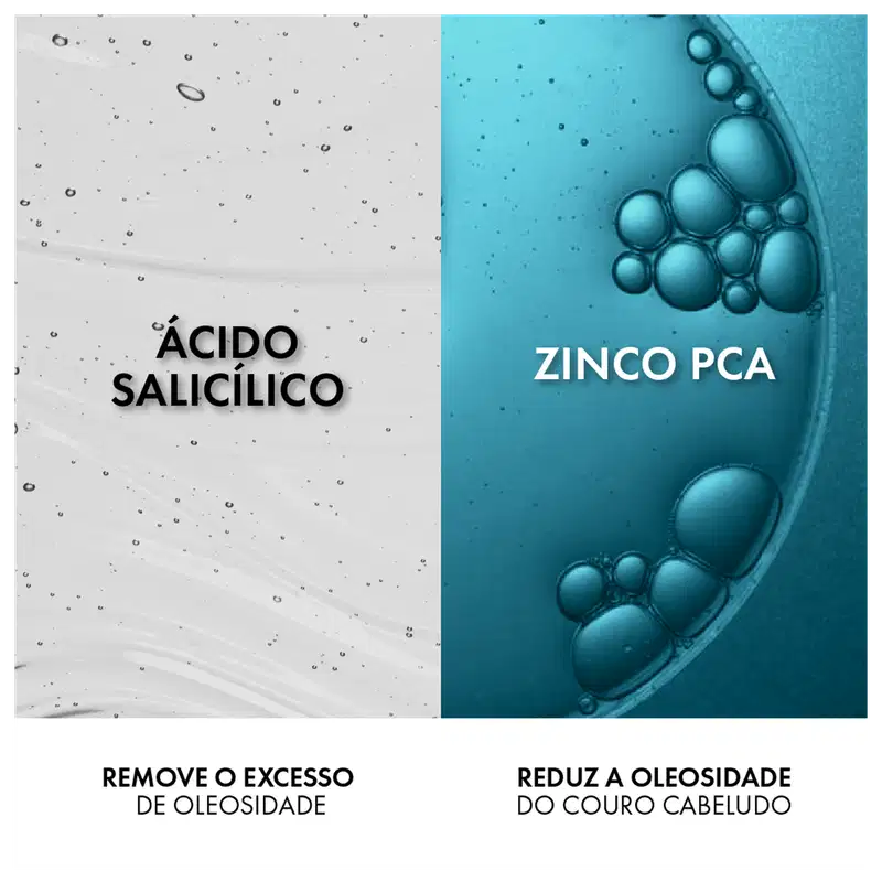 Composto por dois componentes: Ácido Salicílico remove o excesso de oleosidade e Zinco PCA reduz a oleosidade do couro cabeludo.