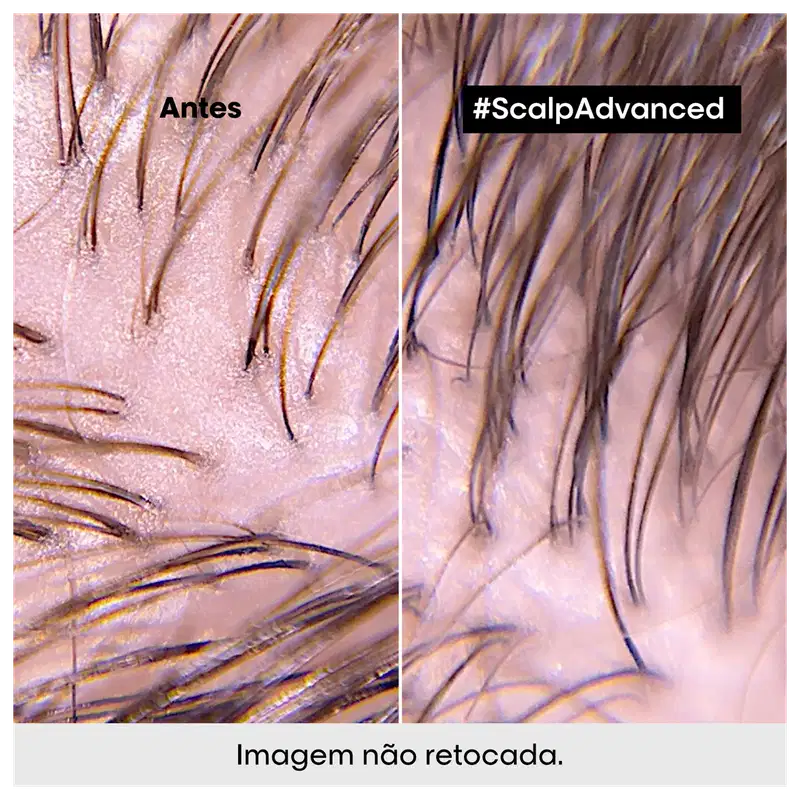 L'Oréal Professionnel Serie Expert Scalp Advanced Argila Purificante - Máscara Capilar 250ml