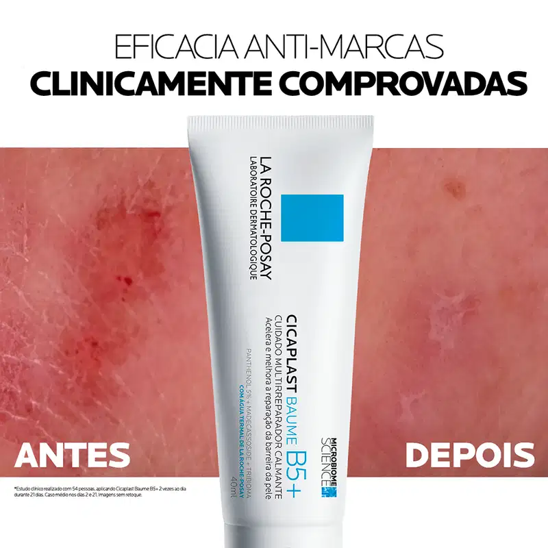 A imagem apresenta um produto da marca La Roche-Posay, um creme anti-marcas clinicamente comprovado. O cenário é minimalista, com fundo vermelho e branco, destacando a embalagem do produto e sua eficácia anti-marcas.