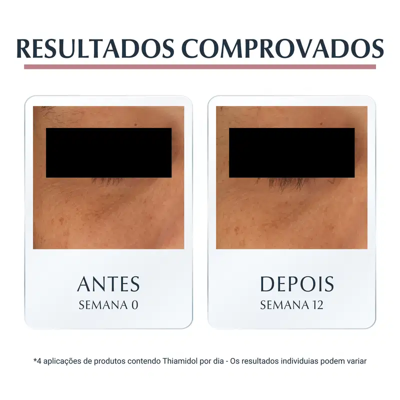 Eucerin Anti-Pigment - Creme Uniformizador para os Olhos 15ml