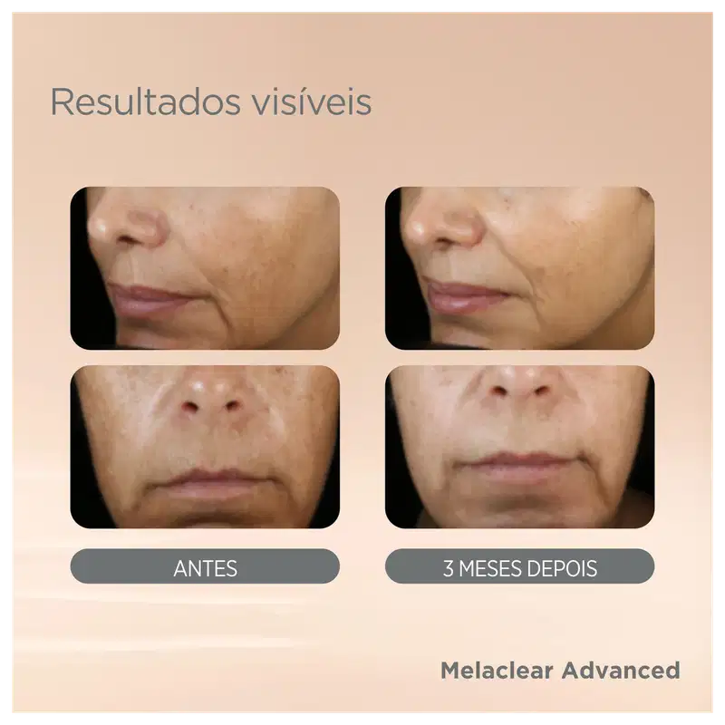 ISDIN ISDINCEUTICS Melaclear Advanced - Sérum Facial Uniformizador 30ml