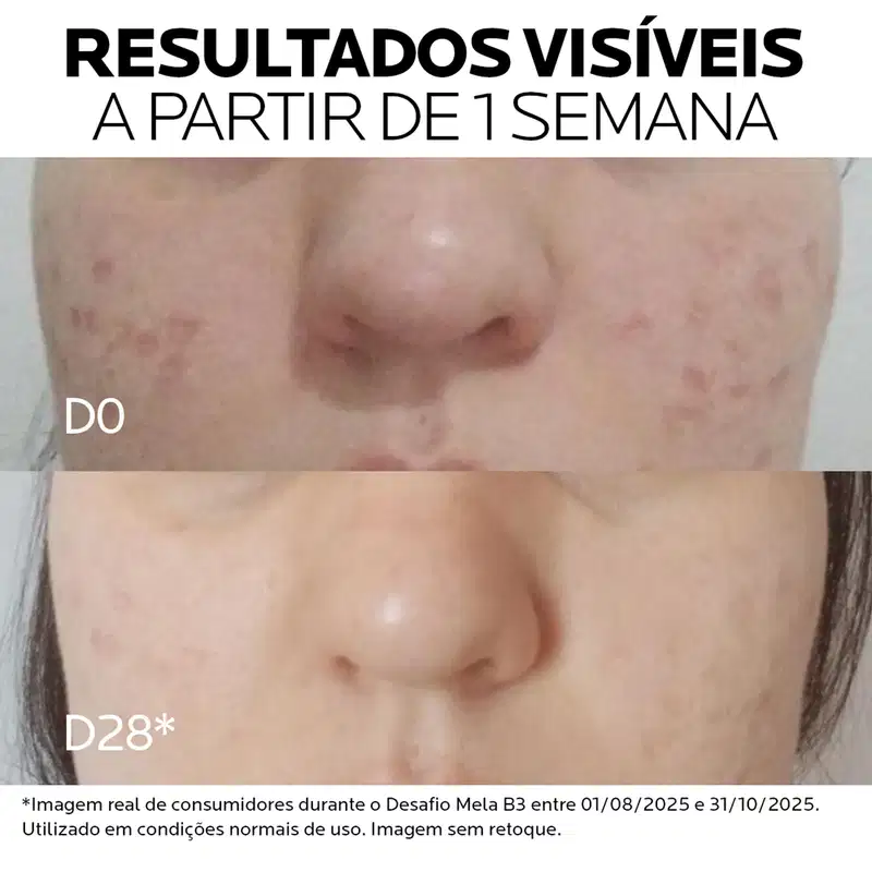 La Roche-Posay Mela B3 - Sérum Facial Antimanchas 30ml