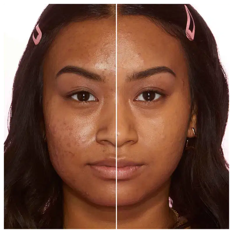A imagem mostra o rosto de uma mulher, com uma linha dividindo o meio do rosto. Do lado esquerdo está sem base e do lado direito, ela está com base no rosto.