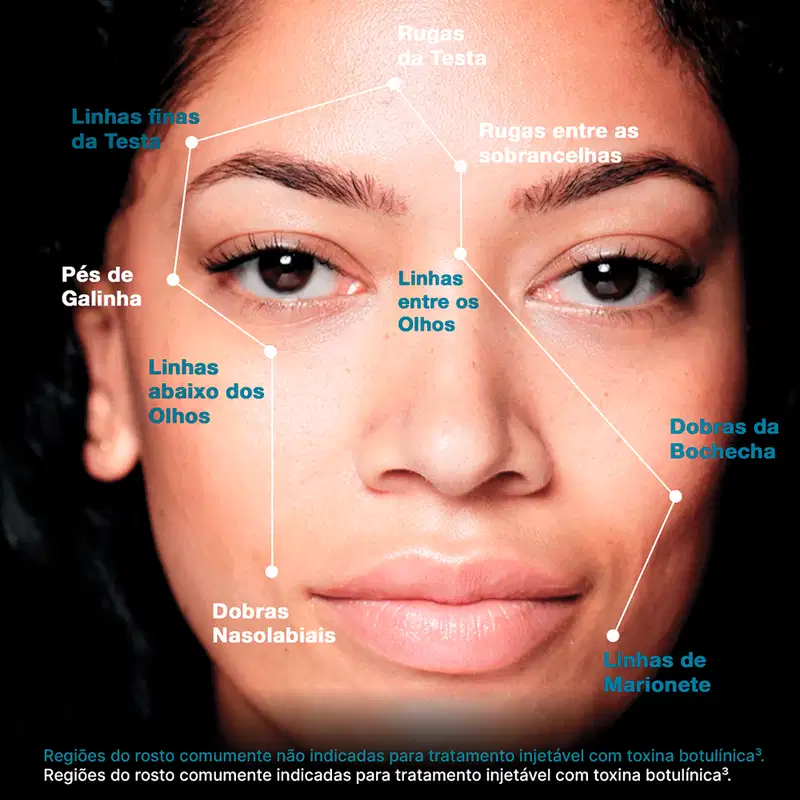 Imagem de rosto feminino com marcações indicando diferentes regiões e linhas do rosto, com texto em português descrevendo cada uma delas.