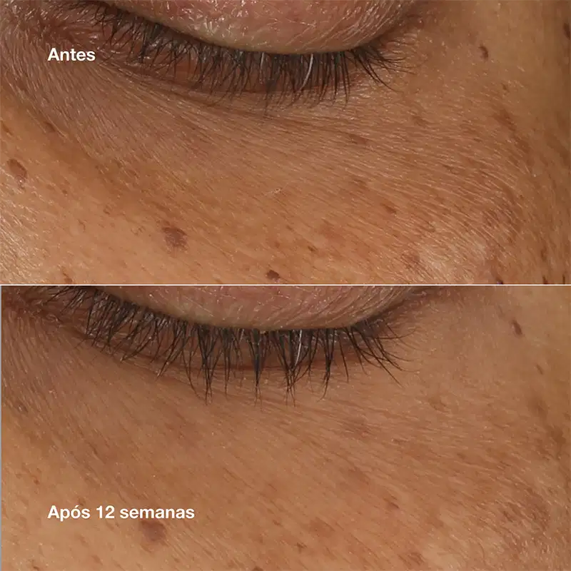 Clinique All About Eyes Brightening Concentrate - Sérum para Área dos Olhos 10ml
