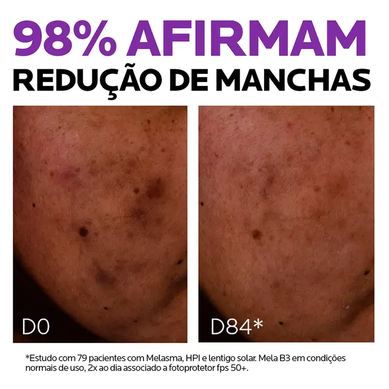 Sérum Redutor de Marcas MelaB3, da marca La Roche-Posay.