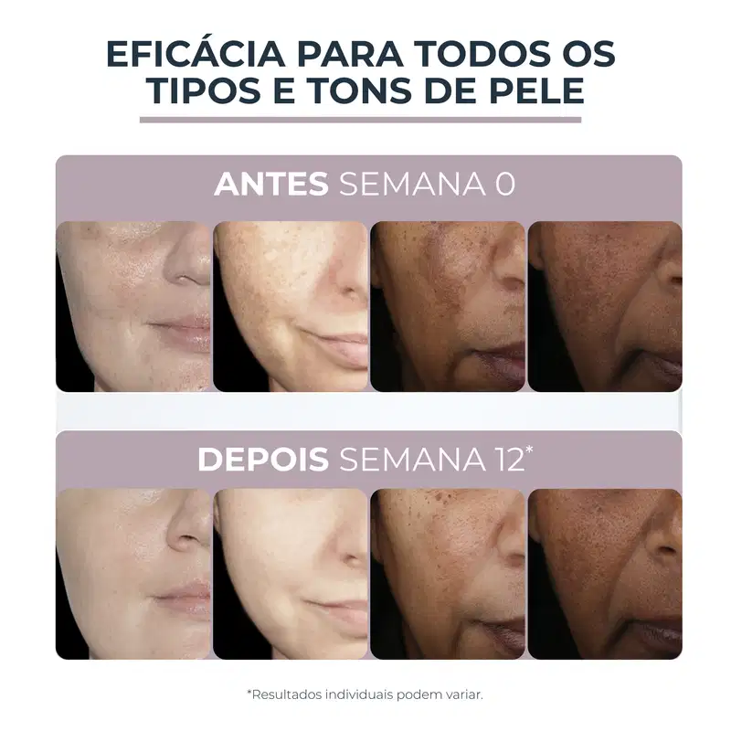 Creme Facial Eucerin Anti-Pigment Clareador Dia FPS 30, 50ml.