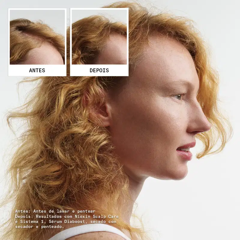 Kit Nioxin Volume Thinning Sistema 1 Trio Care (3 Produtos)