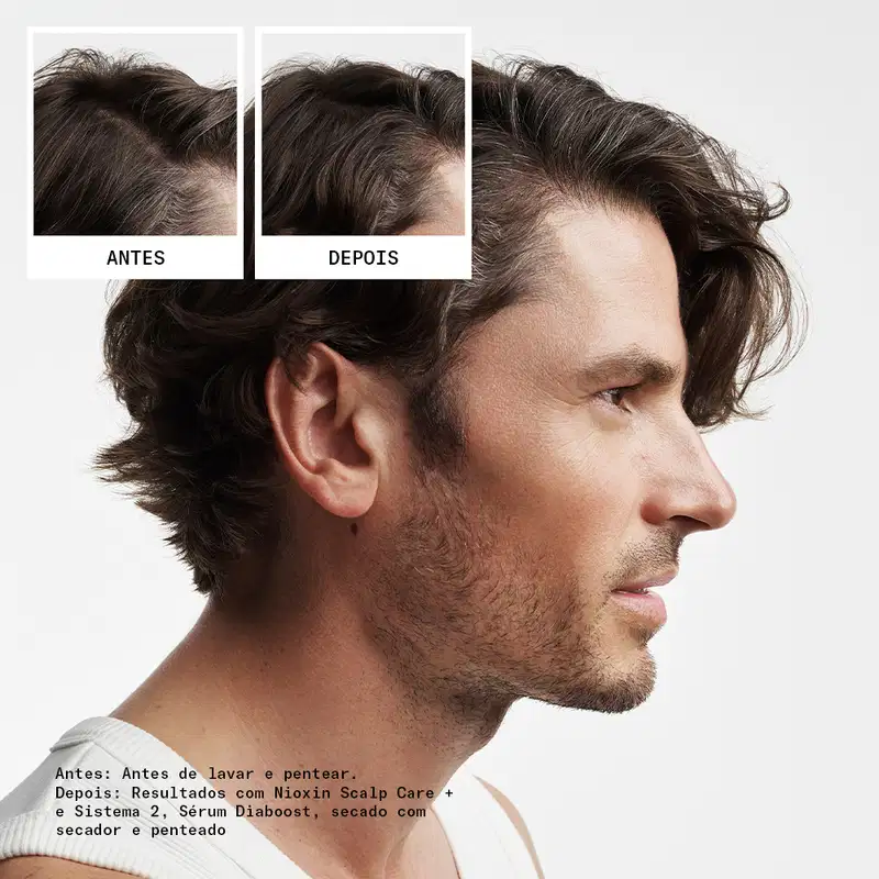 Kit Nioxin Volume Thinning Sistema 2 Trio Care (3 Produtos)