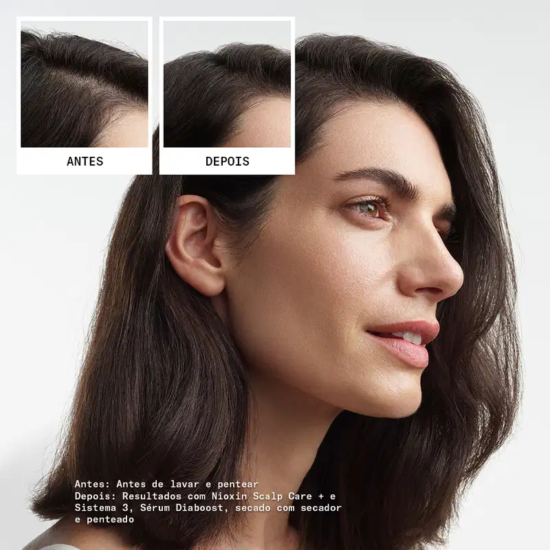 Kit Nioxin Volume Thinning Sistema 3 Trio Care (3 Produtos)
