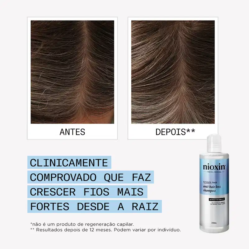 Nioxin Anti-Hair Loss - Shampoo Antiqueda 240ml
