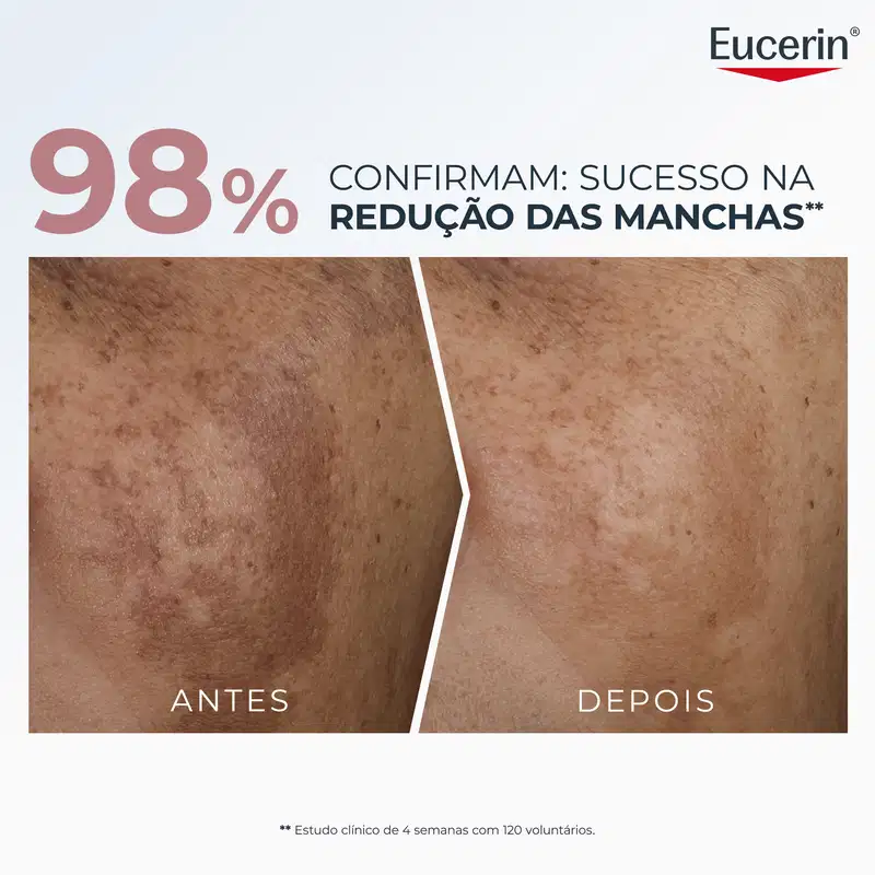 A imagem destaca a eficácia do produto na redução de manchas na pele, com 98% de sucesso comprovado em estudo clínico. O anúncio exibe uma comparação visual antes e depois do uso do produto, mostrando a melhora significativa na aparência da pele.