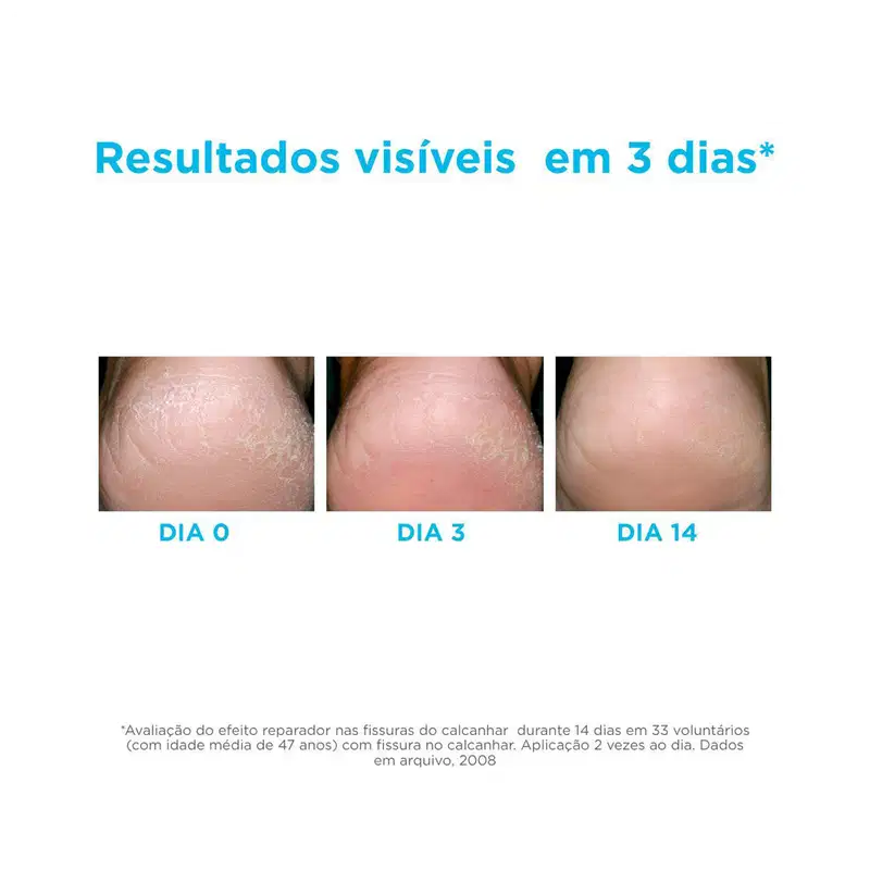 ISDIN Ureadin Podos - Óleo Gel Hidratante para os Pés 80,25g