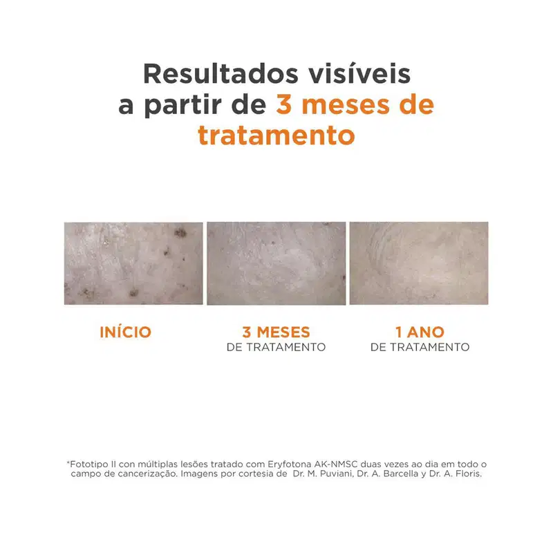 ISDIN Eryfotona AK-NMSC Fluid FPS 99 - Protetor Solar Facial 50ml