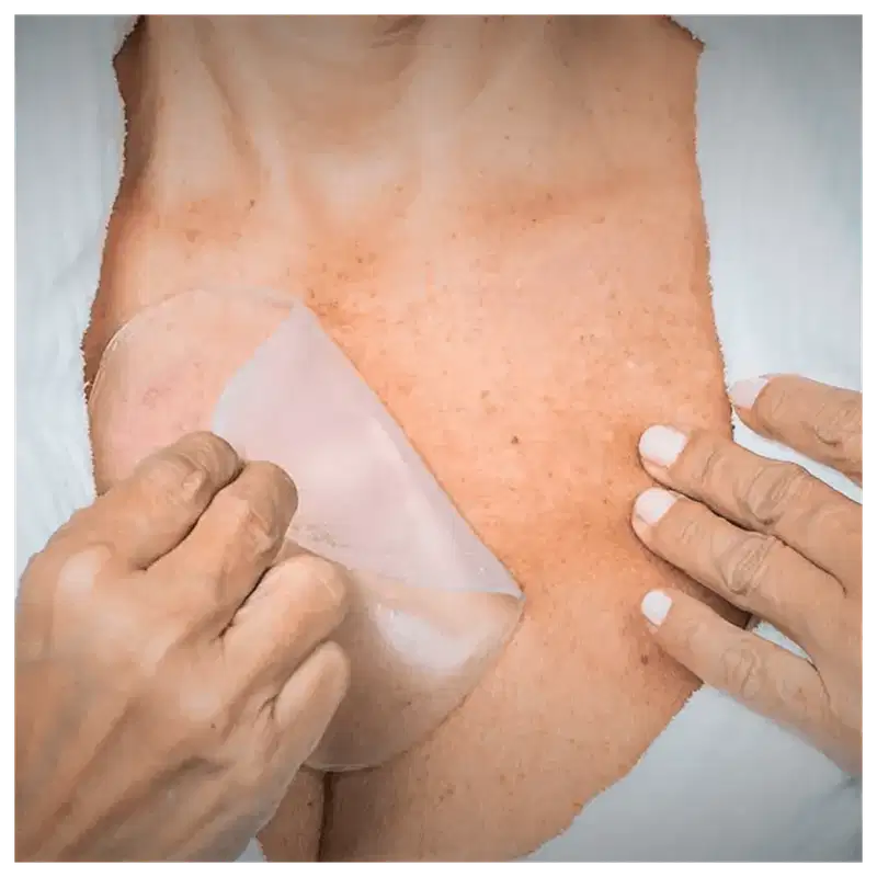 Supérbia Adesivos de Silicone Colo - Tratamento Redutor de Linhas (1 Unidade)