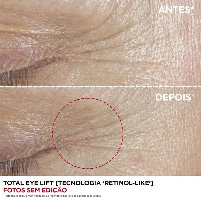 Clarins Total Eye Lift - Creme para Área dos Olhos 15ml