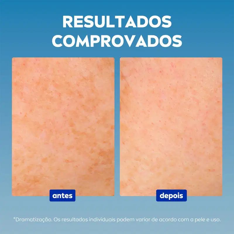 NIVEA Cellular Luminous 630 Antimarcas - Sérum Facial 30ml