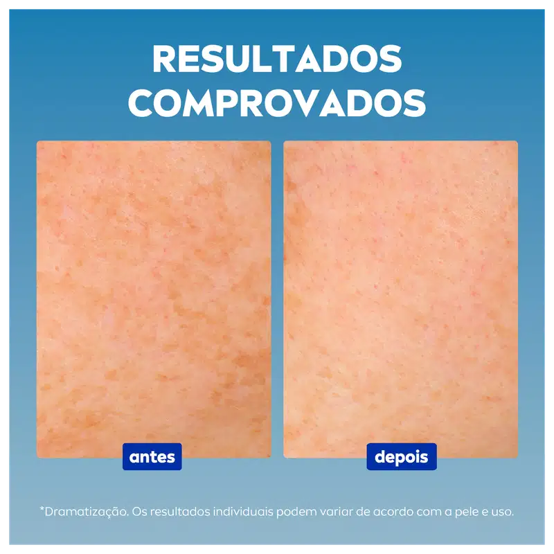 Kit NIVEA Rosto Iluminado (2 produtos)