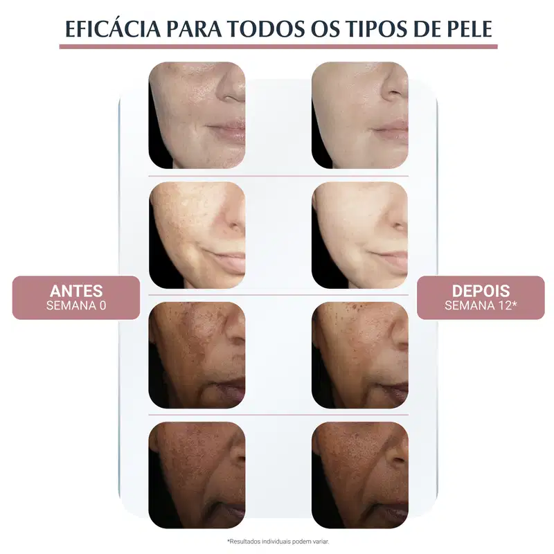 Eucerin Anti-Pigment Uniformizador Dia FPS 30 - Creme Facial 50ml