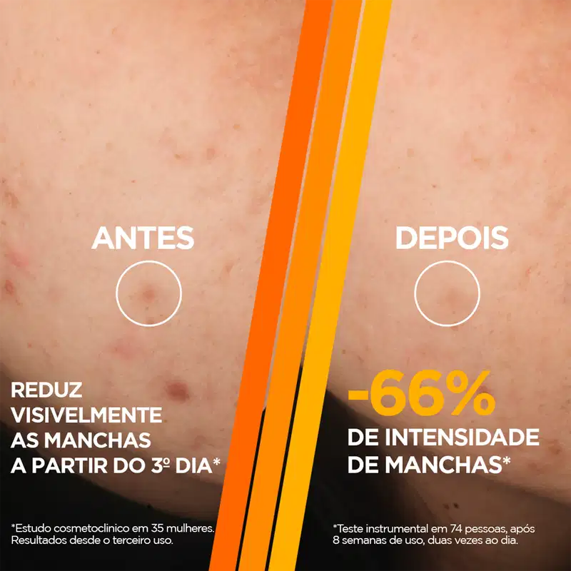 Garnier SkinActive Uniform & Matte Vitamina C Booster - Sérum Facial Antimarcas 30ml