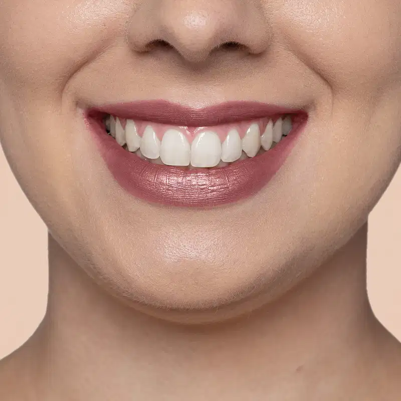 Close-up de um rosto feminino sorridente de pele branca evidenciando os lábios que usam o batom hidratante da marca Quem Disse, Berenice?.