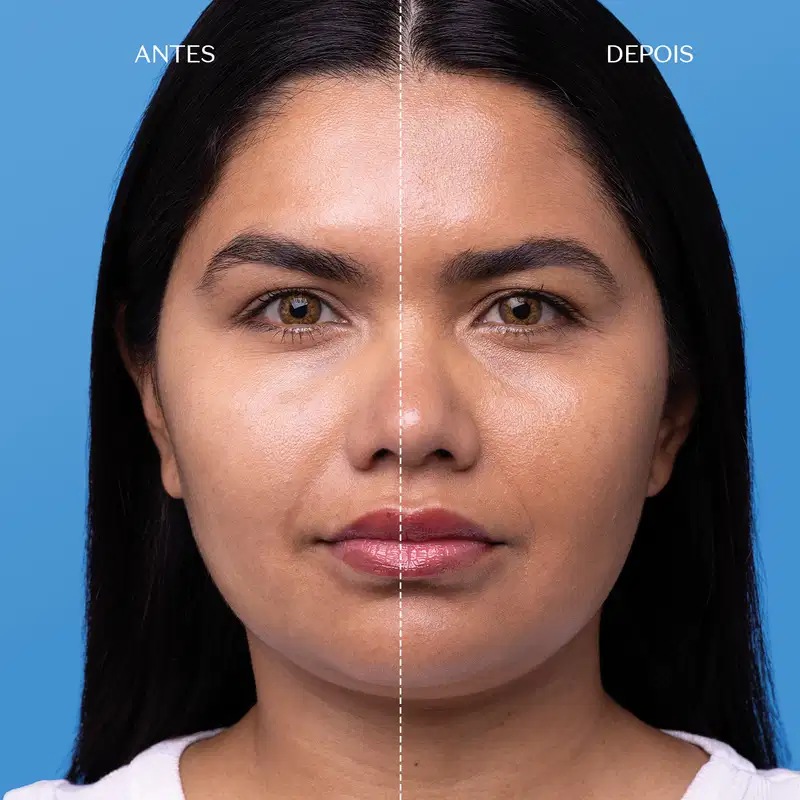 Imagem dividida ao meio por pontilhado branco mostra rosto de mulher com cabelo escuro liso e comprido  sobre fundo azul, mostrando antes e depois de uso de protetor solar com cor.