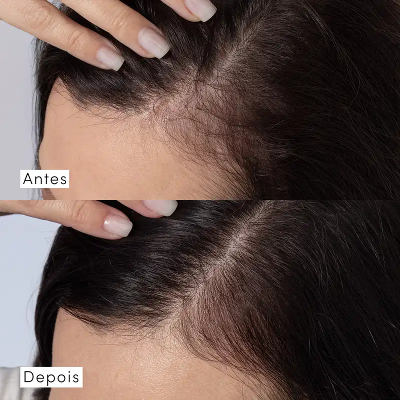 Condicionador Siàge Dermo Hair Resistência Antiqueda 280ml