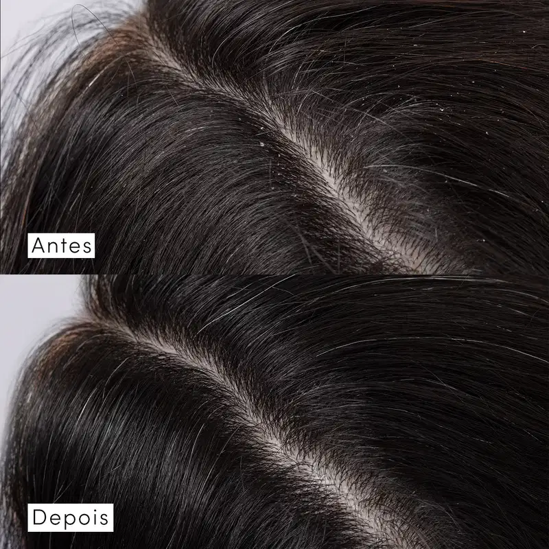Sérum Capilar Multidimensional Siàge Dermo Hair Scalp Rebalance 48ml
