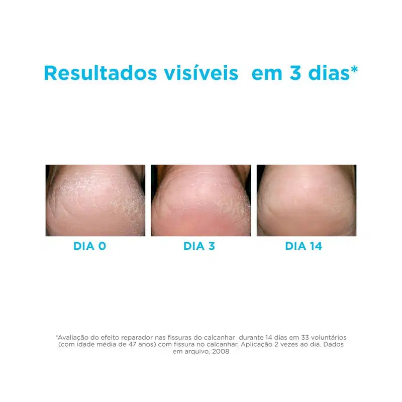 Kit ISDIN Ureadin Podos Fusion Water (2 Produtos)