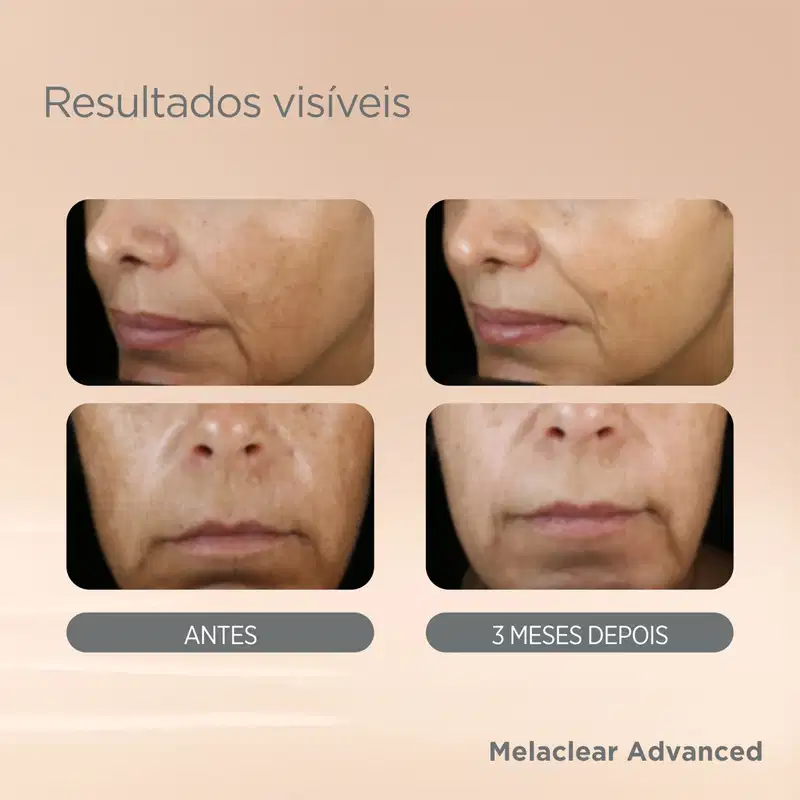 Kit ISDIN Melaclear Advanced Fusion Water (2 Produtos)