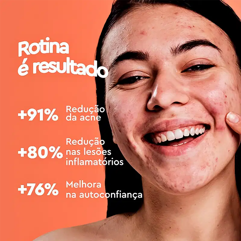 Cimed Acnezil Antisséptico - Sabonete Líquido Facial 200ml