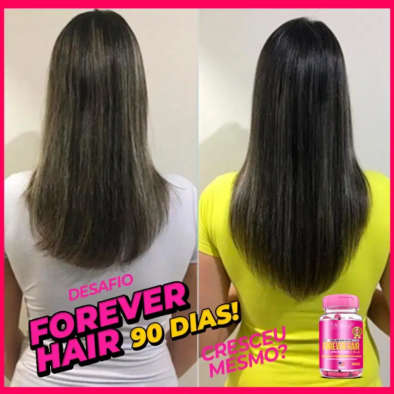 Forever Liss Professional Forever Hair - Suplemento Vitamínico (30 Cápsulas)
