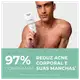 Eucerin Dermo Pure Efeito Triplo - Creme Corporal Antiacne 200ml (7)
