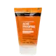 Neutrogena Acne Proofing - Esfoliante Facial 100g (1)