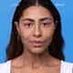 Protetor Solar Facial Com Cor FPS70 Boti.Sun 4.0 40ml (4)