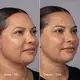 Creme de Contorno Facial Active Pro Bio Colágeno Neo Dermo 50g (6)