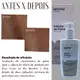 Kit Labotrat Dermo Skin: Inibidor de Pelos Facial e Corporal + Clareador para Virilha e Axilas (3)